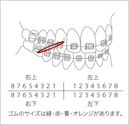 Zp[VC[W